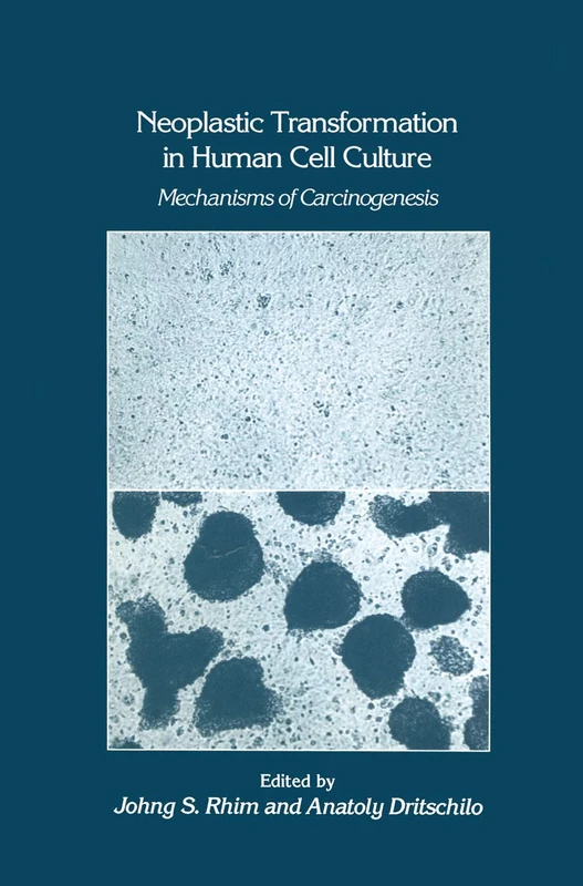 Neoplastic Transformation in Human Cell Culture: Mechanisms of Carcinogenesis: 25 (Experimental Biology and Medicine, 25)