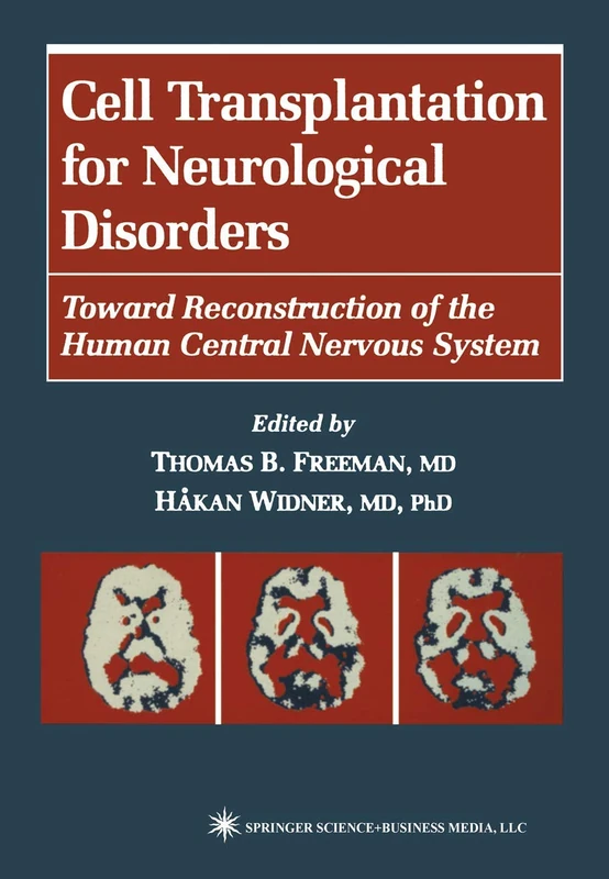 Cell Transplantation for Neurological Disorders: Toward Reconstruction of the Human Central Nervous System (Contemporary Neuroscience)
