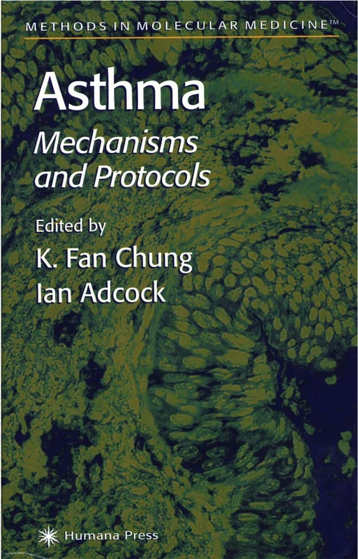 Asthma: 44 (Methods in Molecular Medicine, 44)