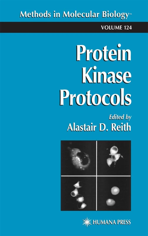 Protein Kinase Protocols: 124 (Methods in Molecular Biology, 124)