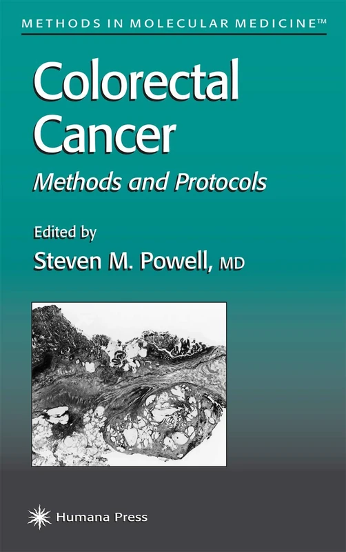 Colorectal Cancer: Methods and Protocols: 50 (Methods in Molecular Medicine, 50)