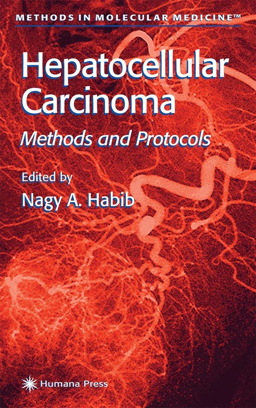 Hepatocellular Carcinoma: Methods and Protocols: 45 (Methods in Molecular Medicine, 45)