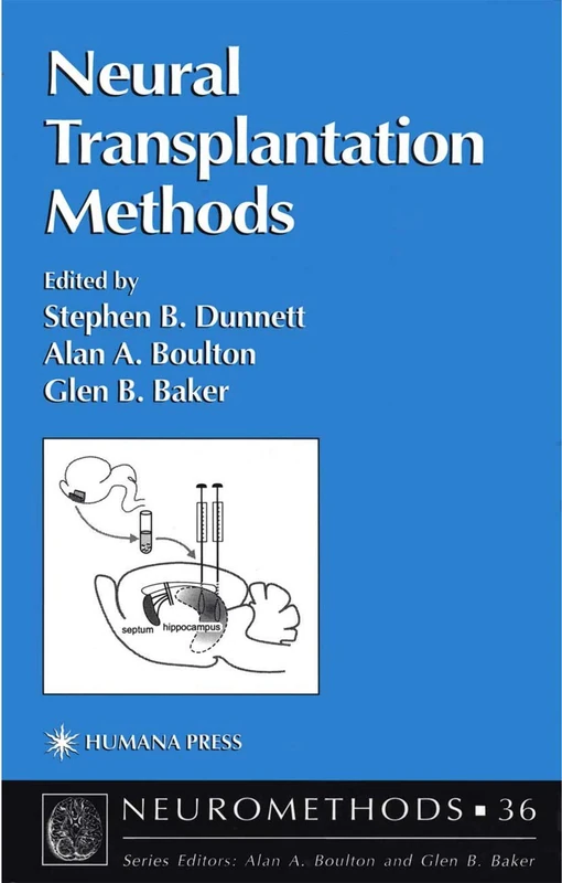 Humana Neural Transplantation Methods: 36 (Neuromethods, 36)