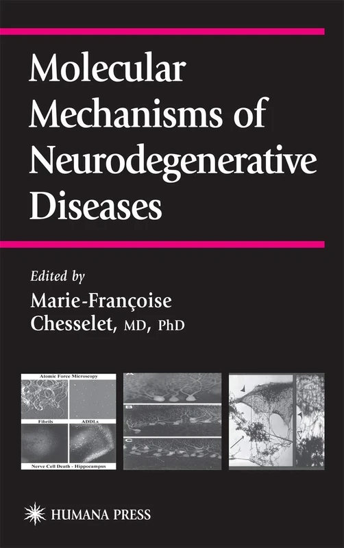 Molecular Mechanisms of Neurodegenerative Diseases (Contemporary Clinical Neuroscience)