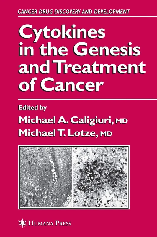 Cytokines in the Genesis and Treatment of Cancer (Cancer Drug Discovery and Development)