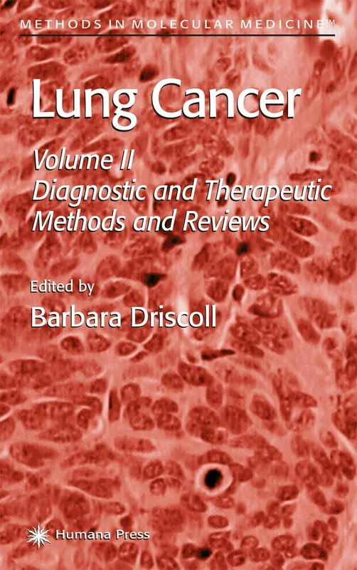 Humana Lung Cancer Volume 2 - Diagnostic and Therapeutic Methods