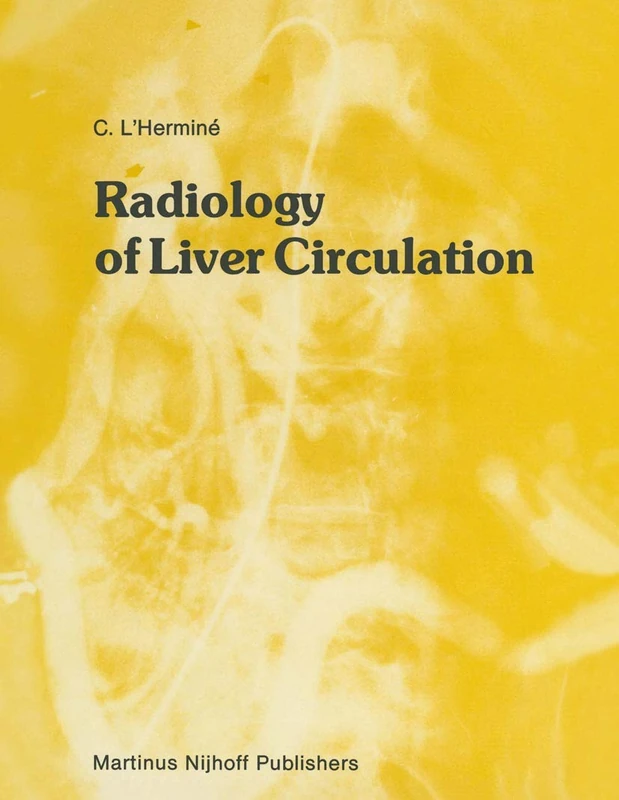 Radiology of Liver Circulation: 11 (Series in Radiology, 11)