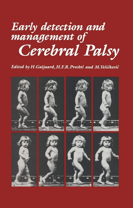 Springer - Early Detection and Management of Cerebral Palsy