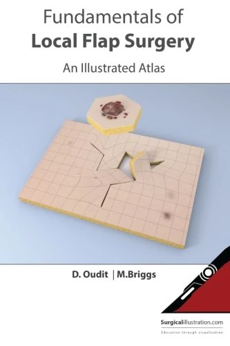Fundamentals of Local Flap Surgery: An Illustrated Atlas