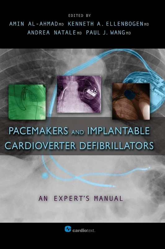 Pacemakers and Implantable Cardioverter Defibrillators: An Expert's Manual