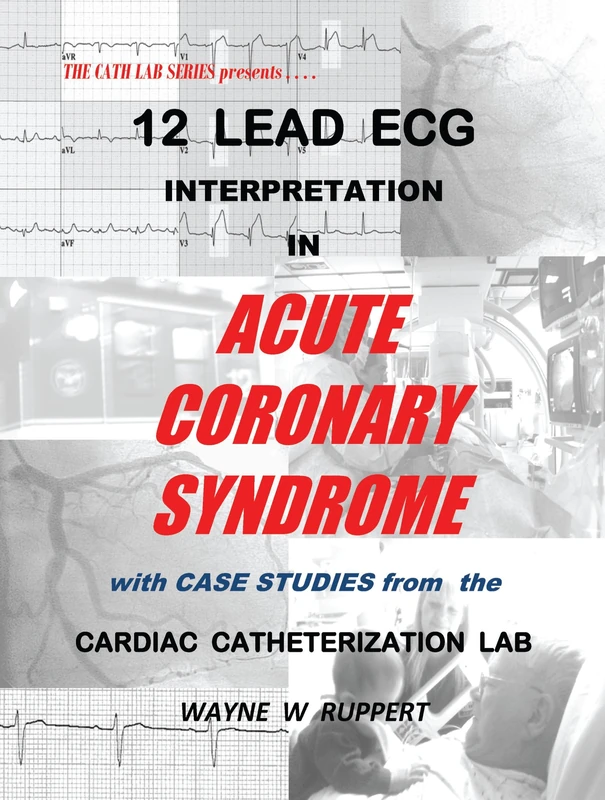 12 Lead ECG Interpretation in Acute Coronary Syndrome with Case Studies from the Cardiac Catheterization Lab