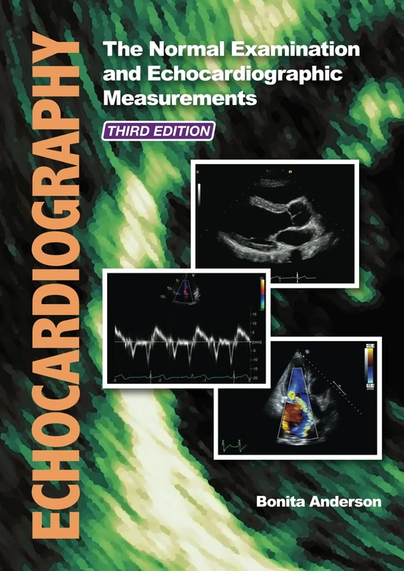 Echocardiography: The Normal Examination and Echocardiographic Measurements