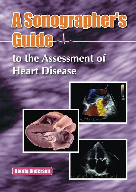 A Sonographer’s Guide to the Assessment of Heart Disease
