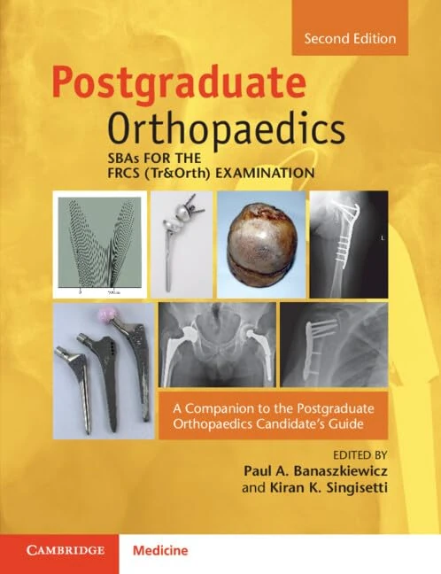 SBAs for the FRCS (Tr&Orth) Examination: A Companion to the Postgraduate Orthopaedics Candidate's Guide