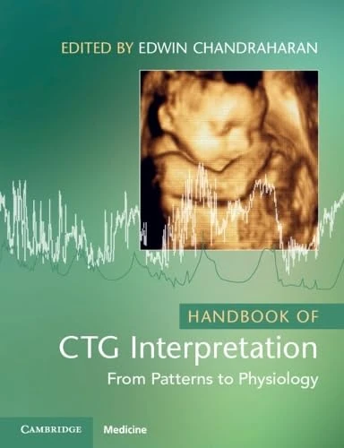 Handbook of CTG Interpretation: From Patterns to Physiology