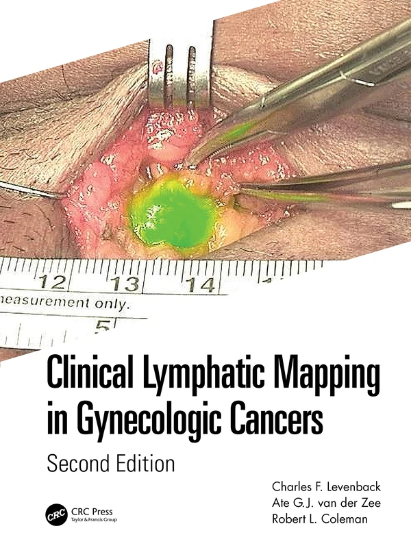 CRC Press - Clinical Lymphatic Mapping in Gynecologic Cancers
