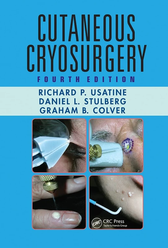 Cutaneous Cryosurgery: Principles and Clinical Practice