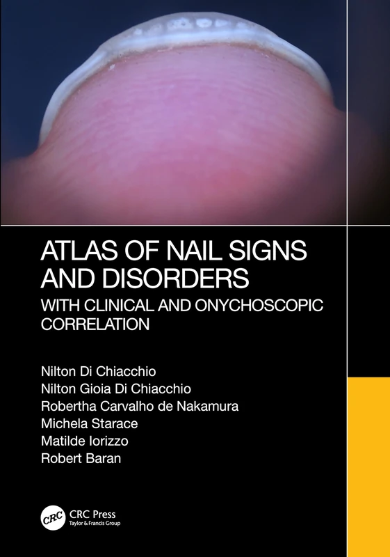 Atlas of Nail Signs and Disorders with Clinical and Onychoscopic Correlation