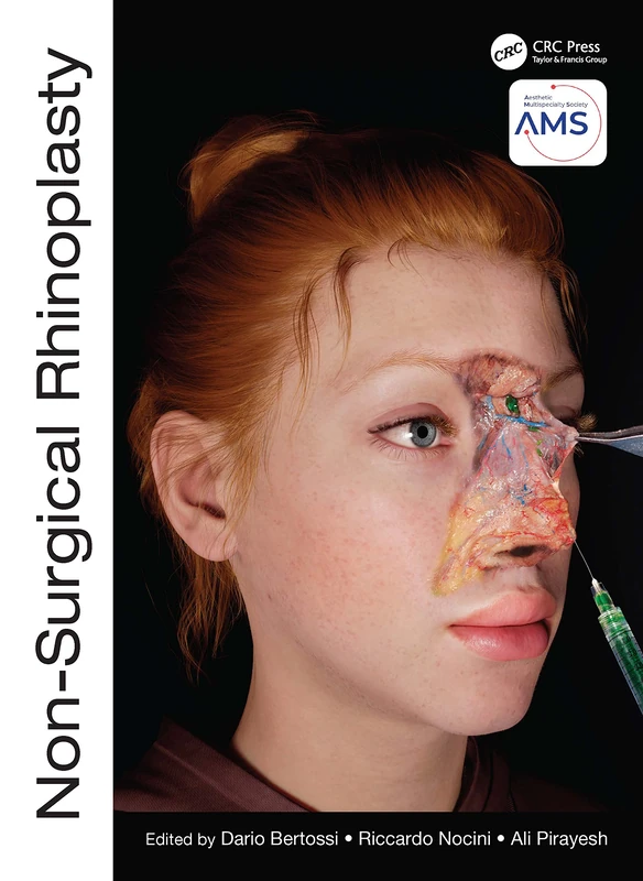 Non-Surgical Rhinoplasty (The PRIME Series)