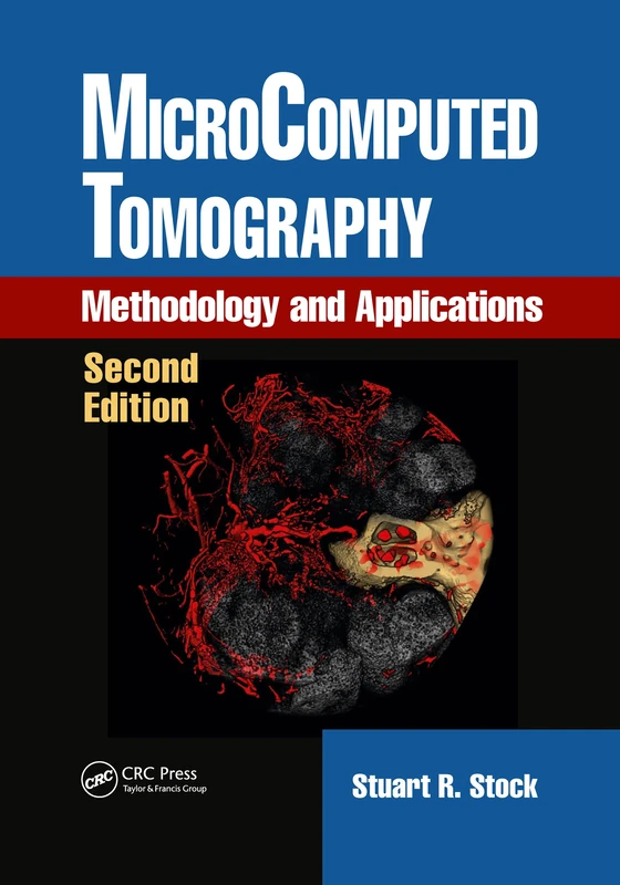 MicroComputed Tomography: Methodology and Applications, Second Edition