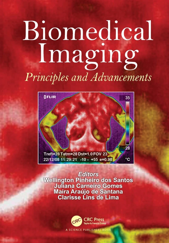 Biomedical Imaging: Principles and Advancements