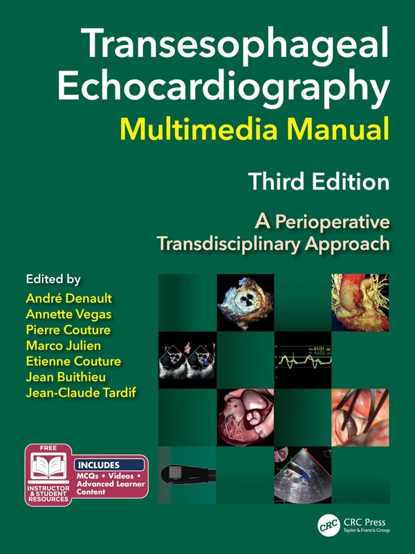 Transesophageal Echocardiography Multimedia Manual: A Perioperative Transdisciplinary Approach