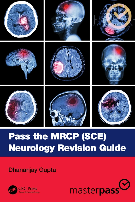Pass the MRCP (SCE) Neurology Revision Guide (MasterPass)