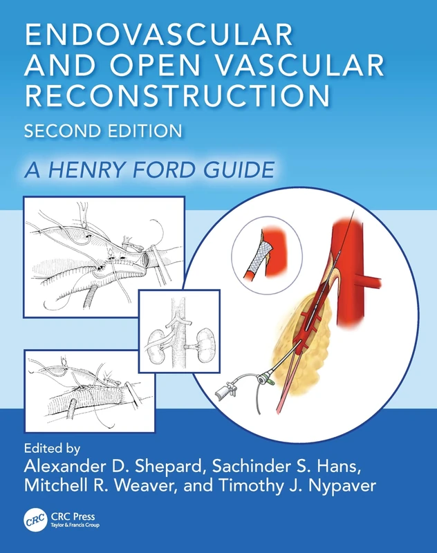 Endovascular and Open Vascular Reconstruction: A Henry Ford Surgical Guide