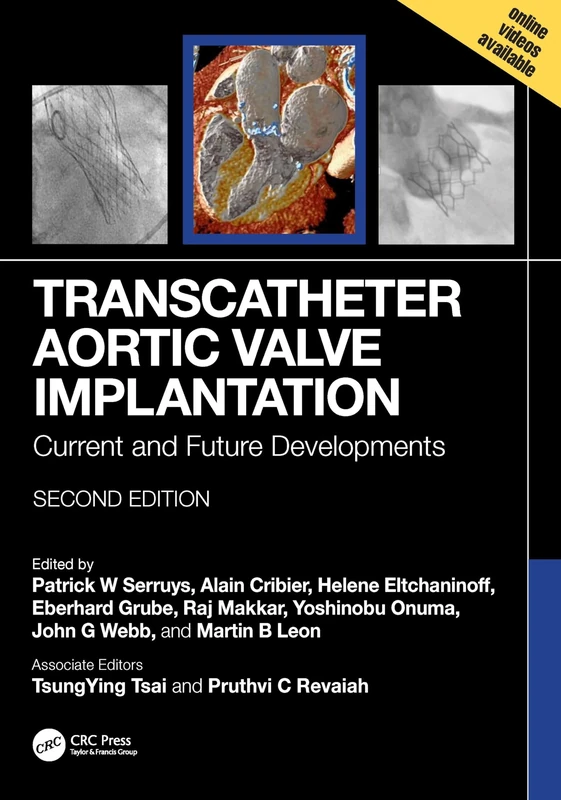 Transcatheter Aortic Valve Implantation: Current and Future Developments