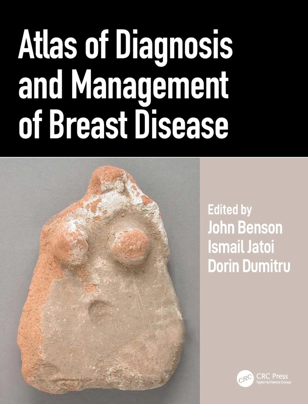 Atlas of Diagnosis and Management of Breast Disease