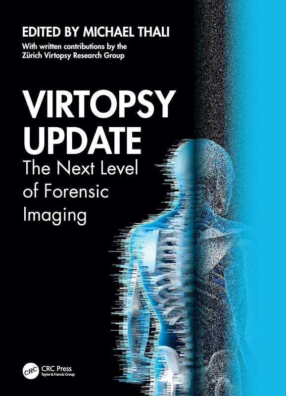 Virtopsy Update: The Next Level of Forensic Imaging - Image 1