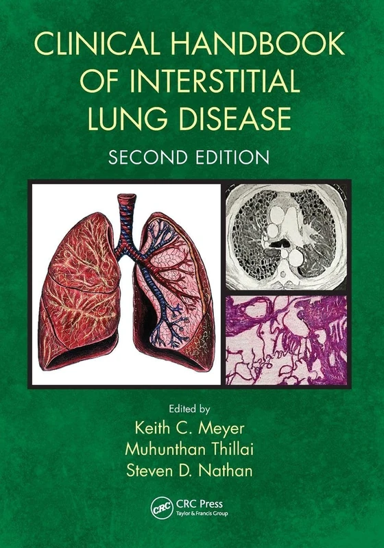 CRC Press - Clinical Handbook of Interstitial Lung Disease