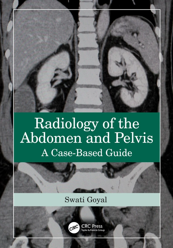 Radiology of the Abdomen and Pelvis: A Case-Based Guide