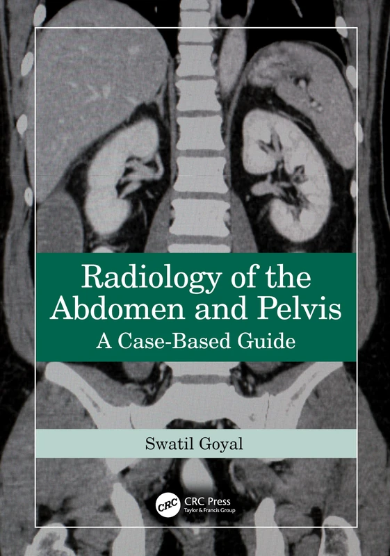 CRC Press Radiology of the Abdomen and Pelvis Case-Based Guide