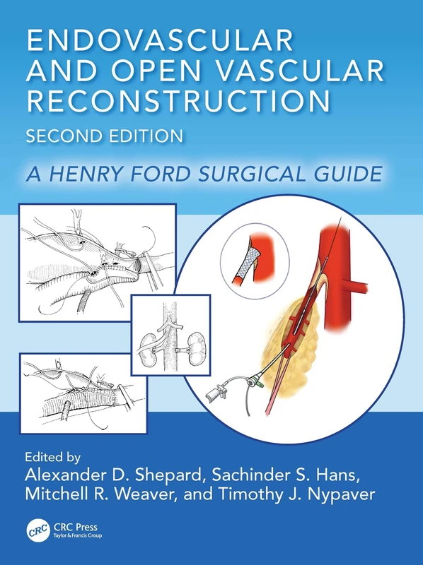 Endovascular and Open Vascular Reconstruction: A Henry Ford Surgical Guide