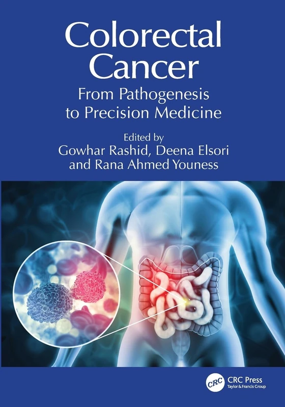 Colorectal Cancer: From Pathogenesis to Precision Medicine