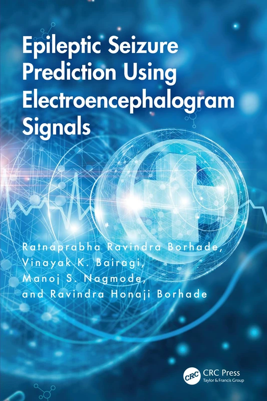 Epileptic Seizure Prediction Using Electroencephalogram Signals
