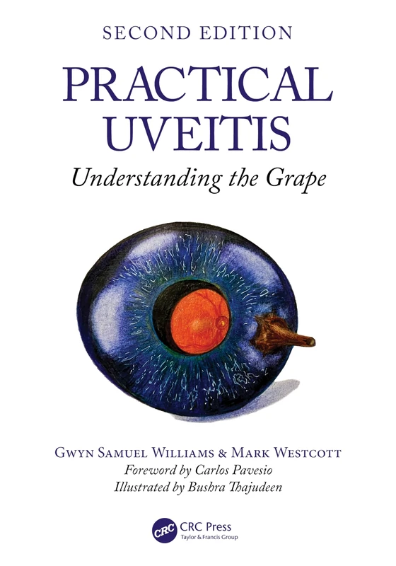 Practical Uveitis: Understanding the Grape