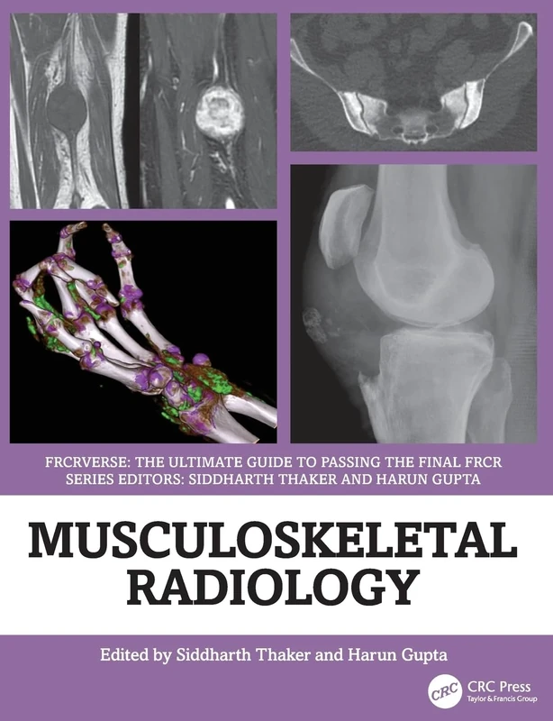 Musculoskeletal Radiology: An Ultimate Guide to Passing the Final FRCR (FRCRverse)