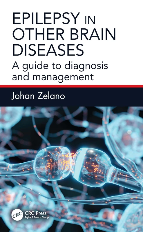 Epilepsy in Other Brain Diseases: A Guide to Diagnosis and Management