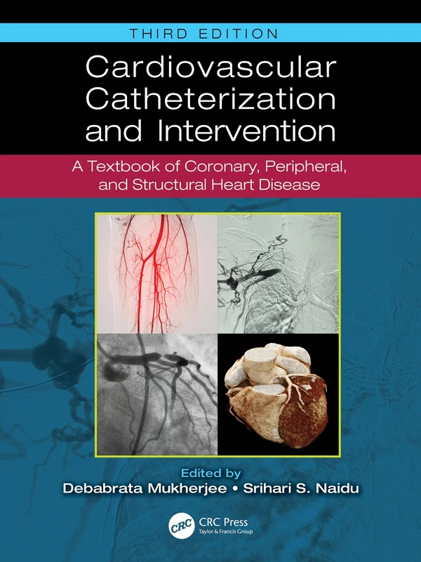 Cardiovascular Catheterization and Intervention: A Textbook of Coronary, Peripheral, and Structural Heart Disease