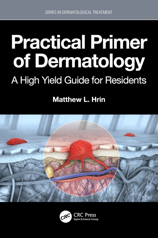 Practical Primer of Dermatology: A High Yield Guide for Residents (Series in Dermatological Treatment)
