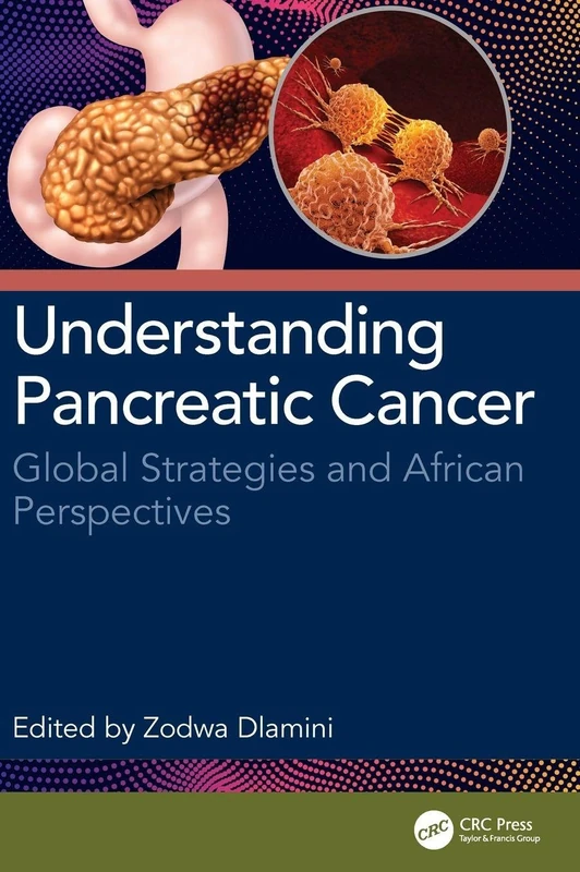 Understanding Pancreatic Cancer: Global Strategies and African Perspectives