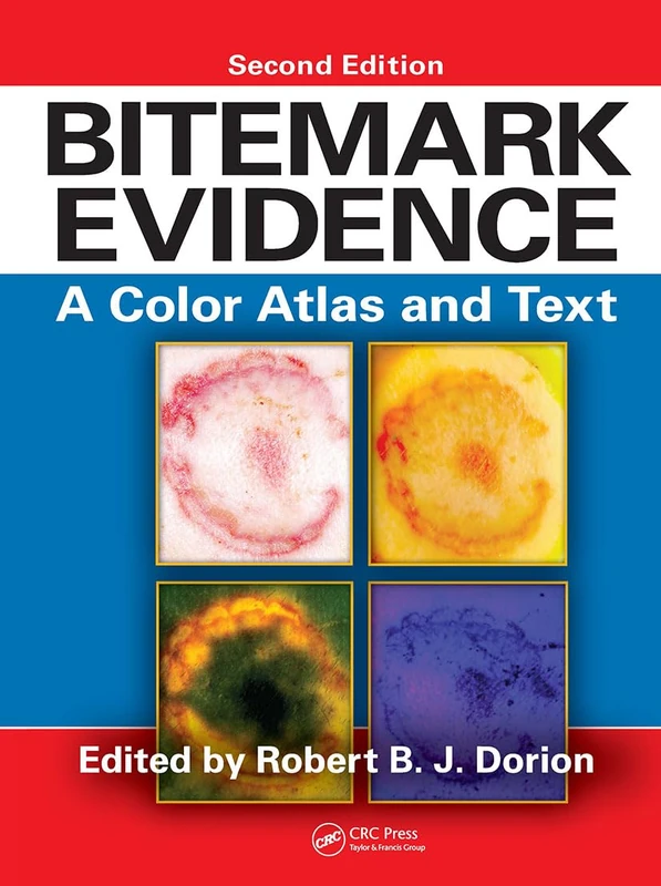 Bitemark Evidence: A Color Atlas and Text, 2nd Edition (International Forensic Science and Investigation)
