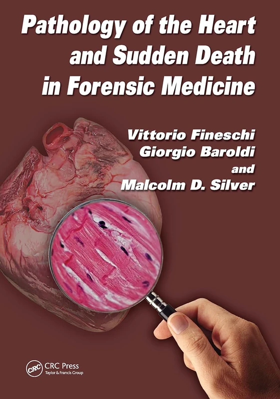 Pathology of the Heart and Sudden Death in Forensic Medicine - Image 1