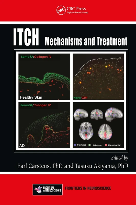 Itch: Mechanisms and Treatment (Frontiers in Neuroscience) - Image 1