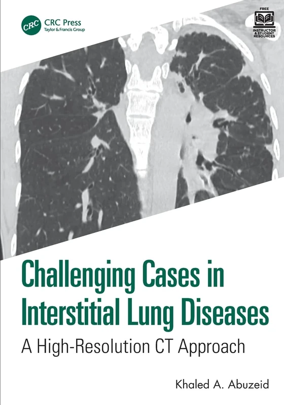Challenging Cases in Interstitial Lung Diseases: A High-Resolution CT Approach
