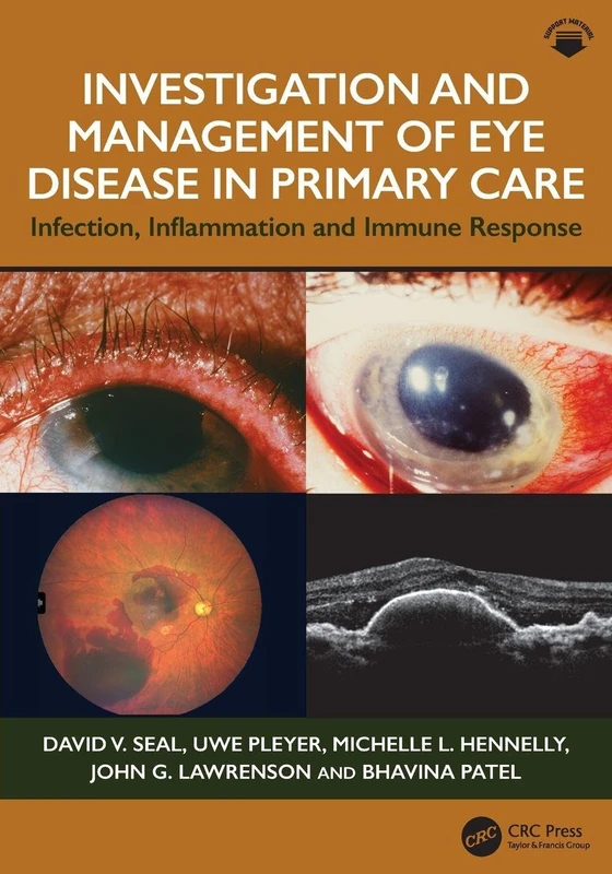 Investigation & Management of Eye Disease in Primary Care: Infection, Inflammation and Immune Response