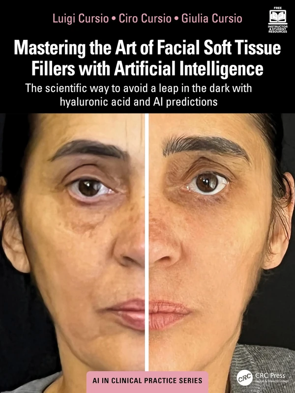 Mastering the Art of Facial Soft Tissue Fillers with Artificial Intelligence: The scientific way to avoid a leap in the dark with hyaluronic acid and AI predictions (AI in Clinical Practice)