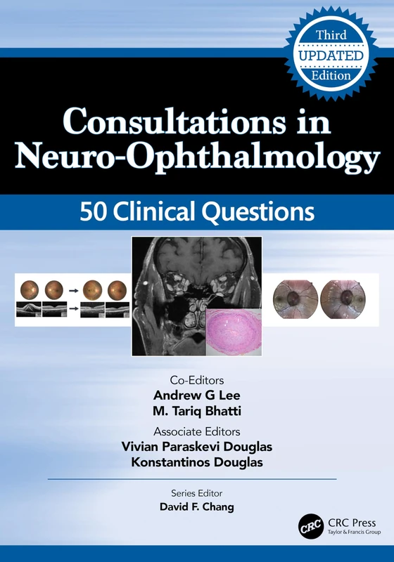 Consultations in Neuro-Ophthalmology: 50 Clinical Questions (Curbside Consultation in Ophthalmology)